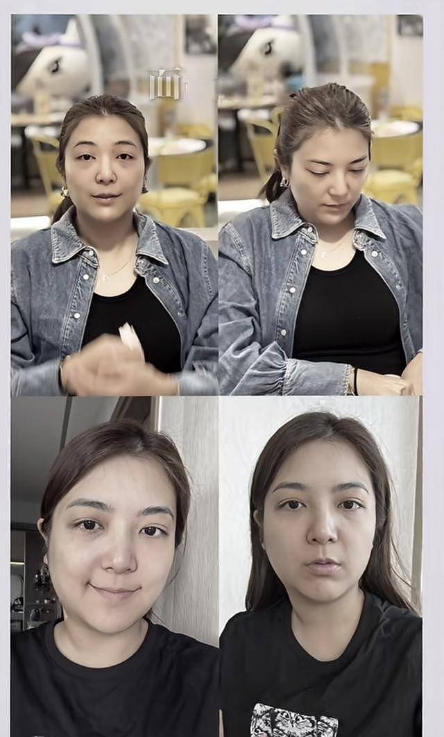 担心！TVB视帝妻子晒近况，面部肿到认不出，状态差（组图） - 3