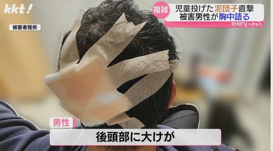 日本男童高空扔泥团致男子头破血流险丧命！事后竟还往警察身上狂喷水…（组图） - 3