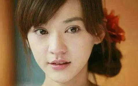 整容了60多次？嫁医生方便终身动脸，削骨换脸都是小场面，她对“人工制造”上瘾了？（组图） - 51