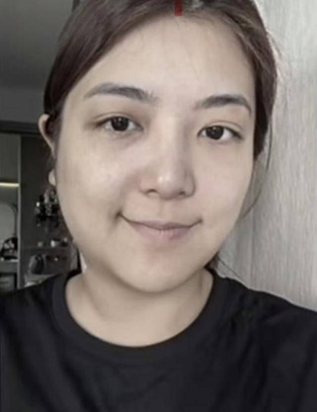 担心！TVB视帝妻子晒近况，面部肿到认不出，状态差（组图） - 4