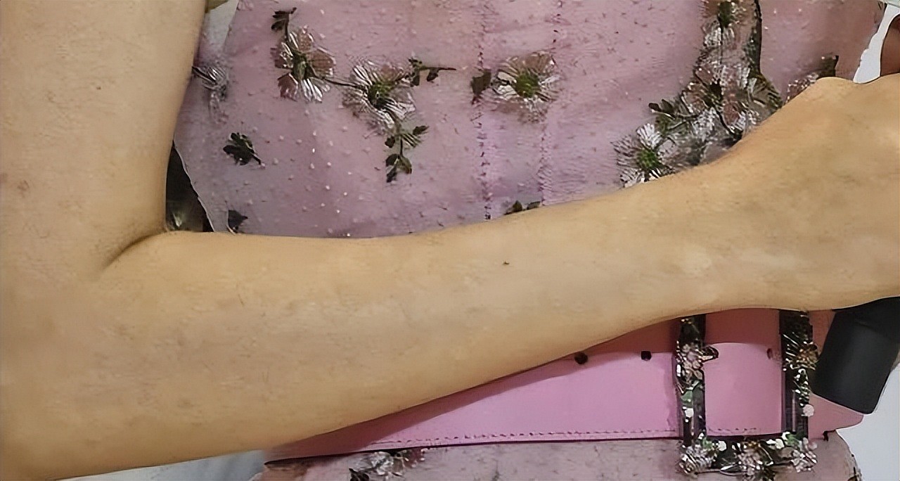 假胸、假屁股、假肌肉,半个娱乐圈从头假到脚,还有什么是真的(组图) - 3