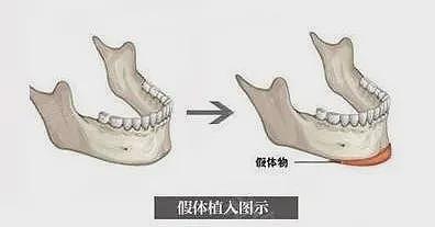 宋祖儿复出二连爆,80斤都不到的她是怎么哭出双下巴的?(组图) - 19