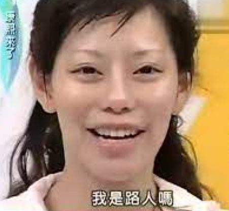 整容了60多次？嫁医生方便终身动脸，削骨换脸都是小场面，她对“人工制造”上瘾了？（组图） - 5