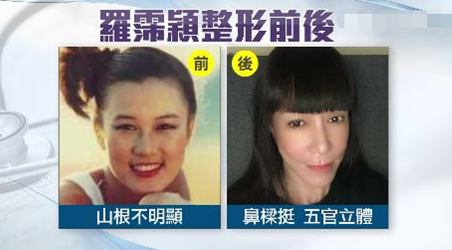 整容了60多次？嫁医生方便终身动脸，削骨换脸都是小场面，她对“人工制造”上瘾了？（组图） - 8