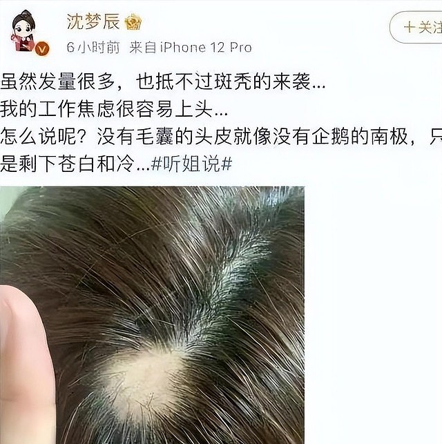假胸、假屁股、假肌肉,半个娱乐圈从头假到脚,还有什么是真的(组图) - 19