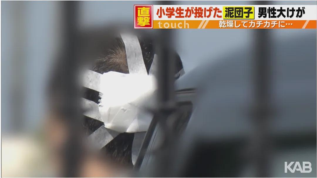 日本男童高空扔泥团致男子头破血流险丧命！事后竟还往警察身上狂喷水…（组图） - 9