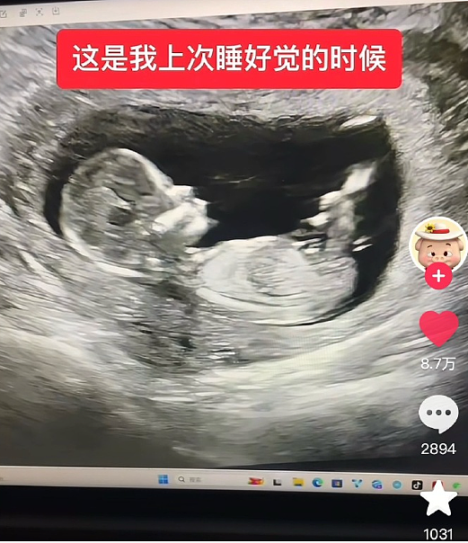 【爆笑】男朋友和女生朋友单独出去看电影?网友无语:不分!有你哭的(组图) - 34