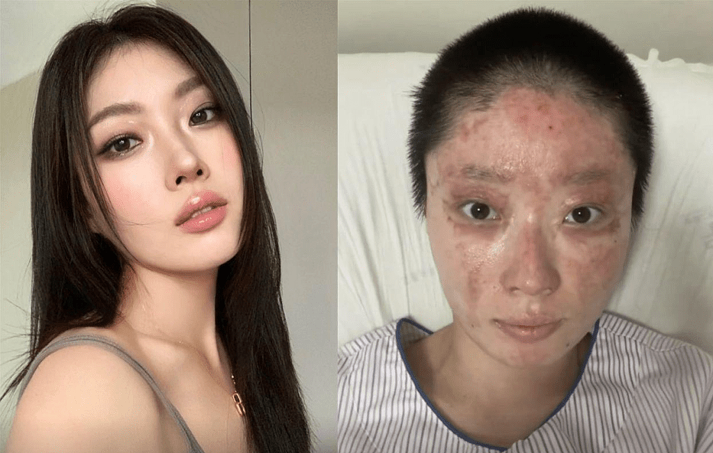 沈阳27岁美妆网红一家三口烧伤毁容，拍康复片被质疑搏同情（组图） - 10