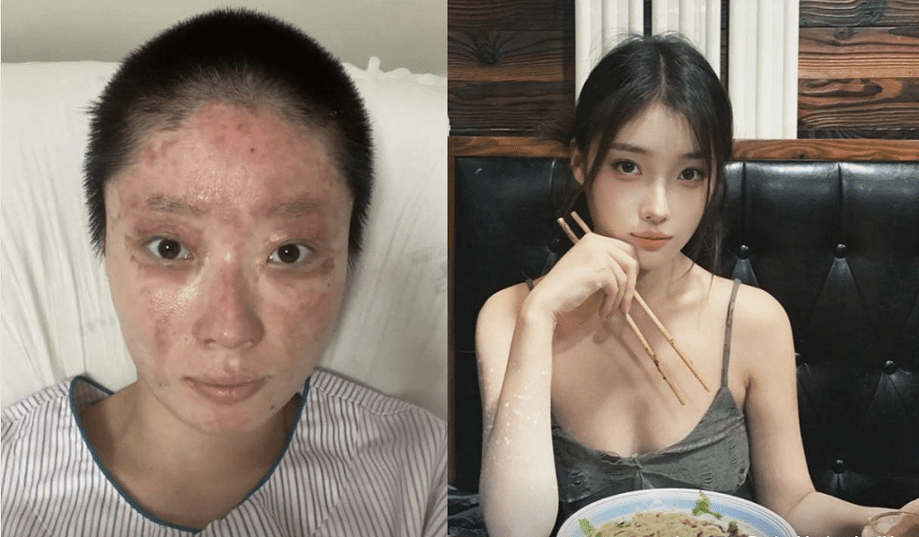 沈阳27岁美妆网红一家三口烧伤毁容，拍康复片被质疑搏同情（组图） - 8