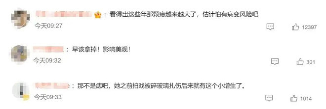 孙俪最新亮相唇下痣消失！本人透露：下巴拔出玻璃（组图） - 8