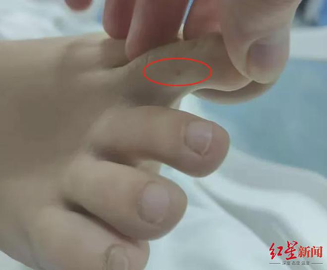 疑被蛇咬伤身亡女子表弟发声：被咬地系三亚市区人行道，表姐已在新加坡申请读研（组图） - 3