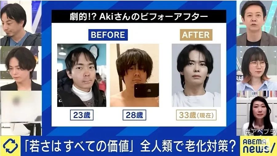 小哥长得太着急,23岁秃头还被甩!他努力抗老十年,现在...算逆生长吗?(组图) - 8