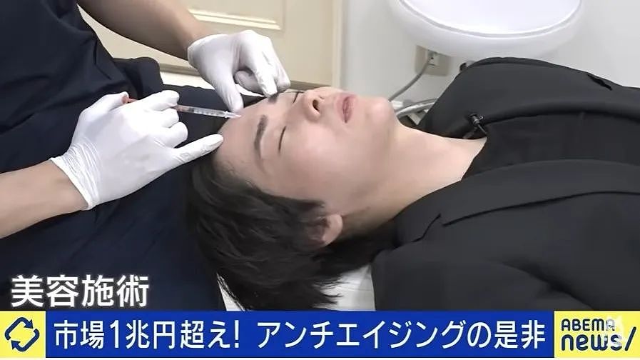小哥长得太着急,23岁秃头还被甩!他努力抗老十年,现在...算逆生长吗?(组图) - 5