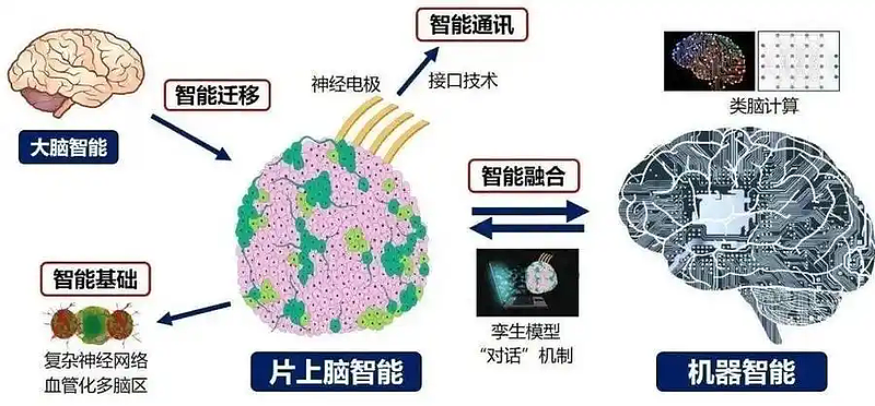 中媒:可以刷医保!脑机接口进入医保定价时代(组图) - 14