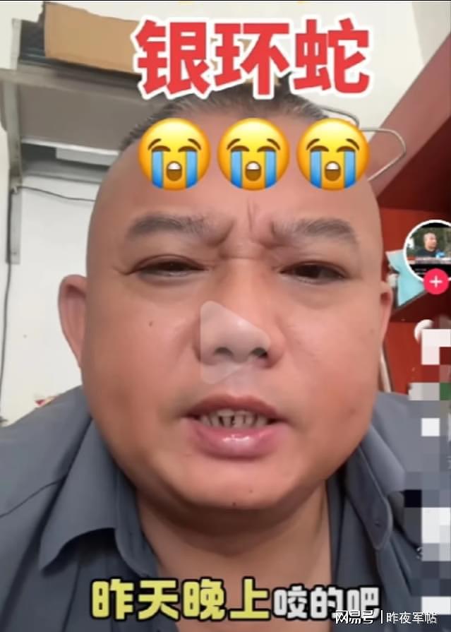 三亚毒蛇咬死人，医生表现像小白！深圳蛇咬人抢救成功率有多高？（组图） - 3