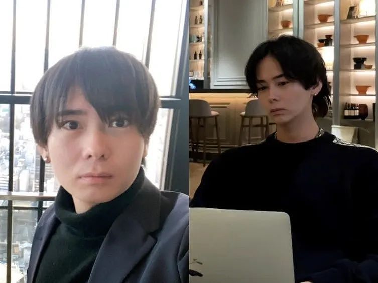 小哥长得太着急,23岁秃头还被甩!他努力抗老十年,现在...算逆生长吗?(组图) - 9