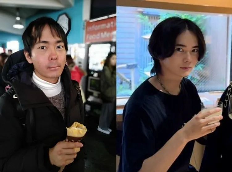 小哥长得太着急,23岁秃头还被甩!他努力抗老十年,现在...算逆生长吗?(组图) - 18