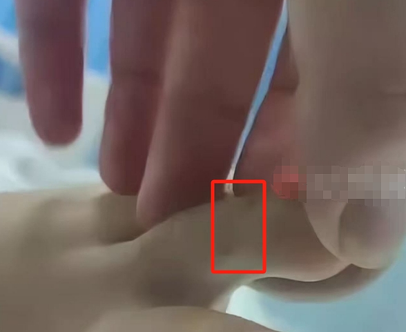 新加坡美女幼师去海南度假疑遭毒蛇咬伤,数小时后不治身亡!更多细节曝光(组图) - 2