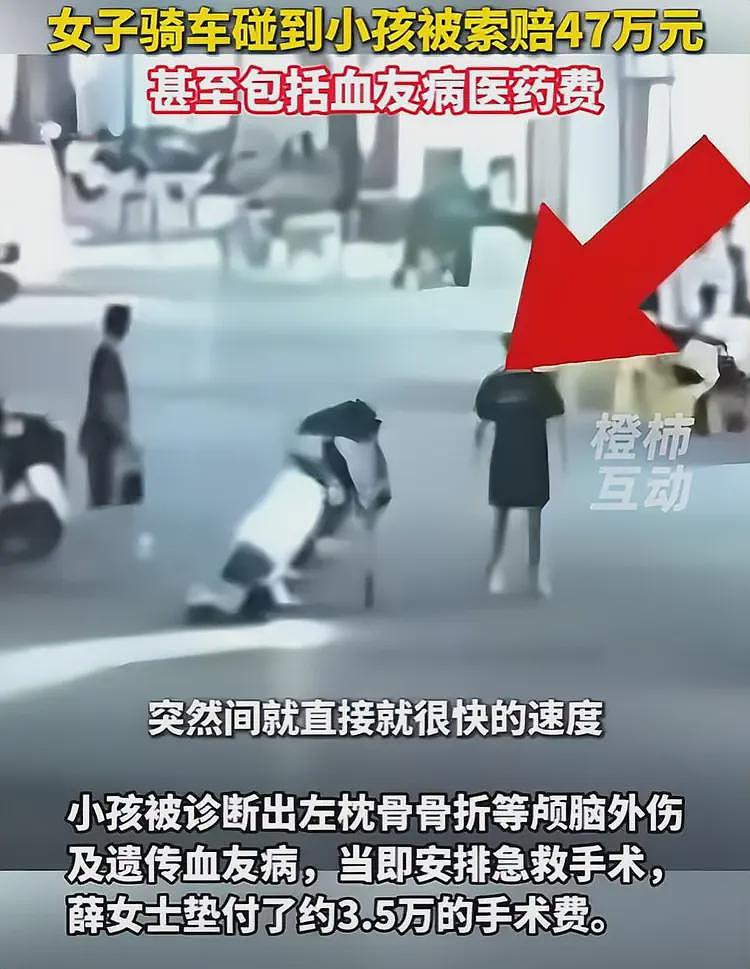 监控曝光！女子被血友病患儿“碰瓷”判全责，索赔47万引争议（组图） - 3
