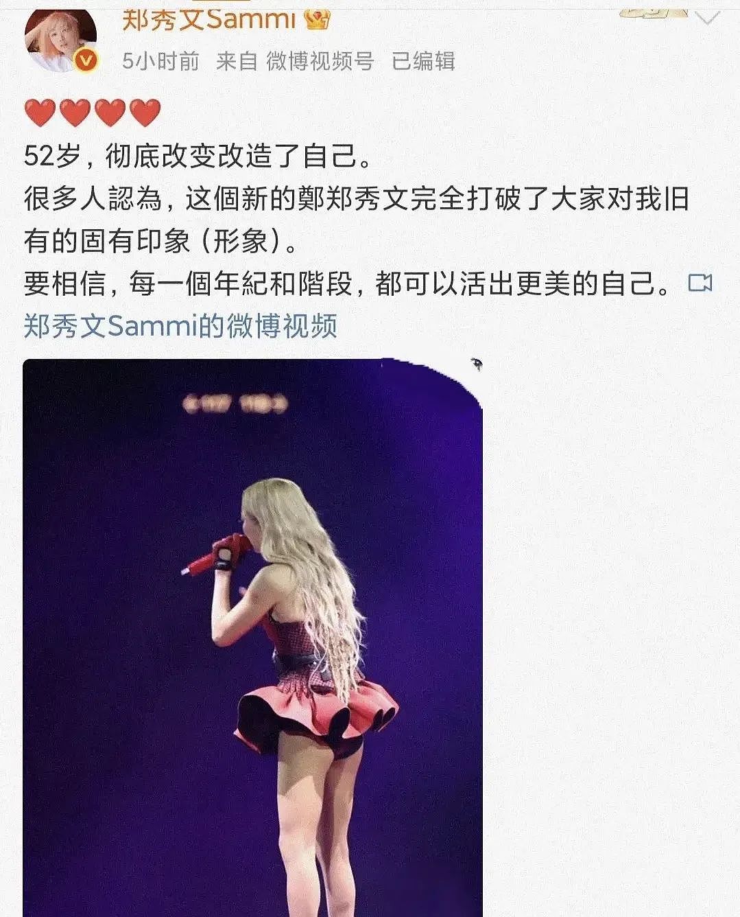 52岁郑秀文一次比一次大胆!网友:穿条安全裤吧(组图) - 1