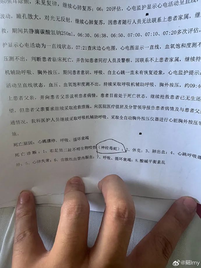 确认为毒蛇咬伤！被不明物咬伤身亡女子家属公布死亡诊断（组图） - 1