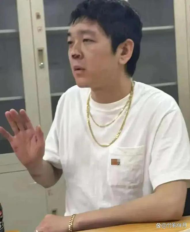 曝马思纯男友又被打！半夜醉醺醺进急诊鼻子受伤，网友喊女方快分（组图） - 6