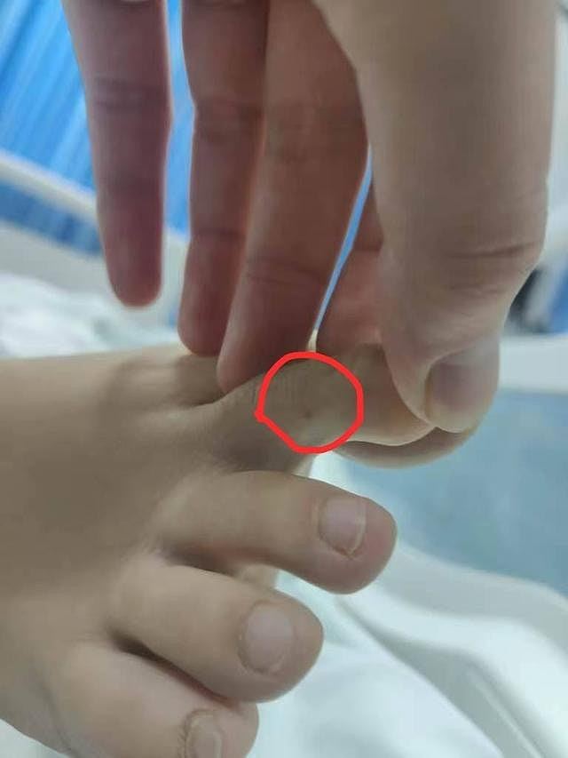 女子三亚旅游疑遭毒蛇咬死后续：抢救记录曝光，专家称银环蛇惹祸（组图） - 5