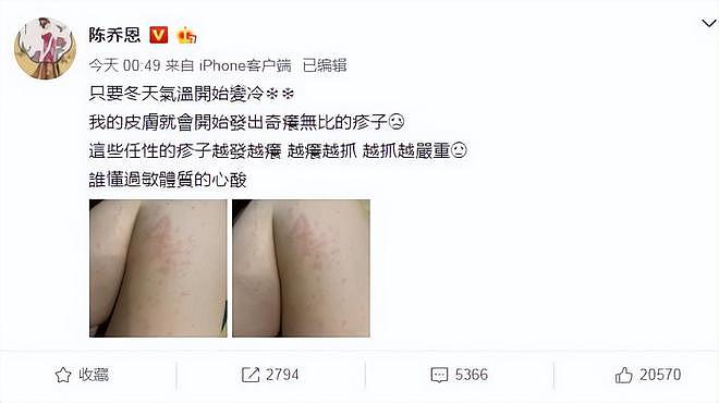 陈乔恩做“针雕”吓坏网友，全身插满上千支钢针，连脚趾也没放过（组图） - 7