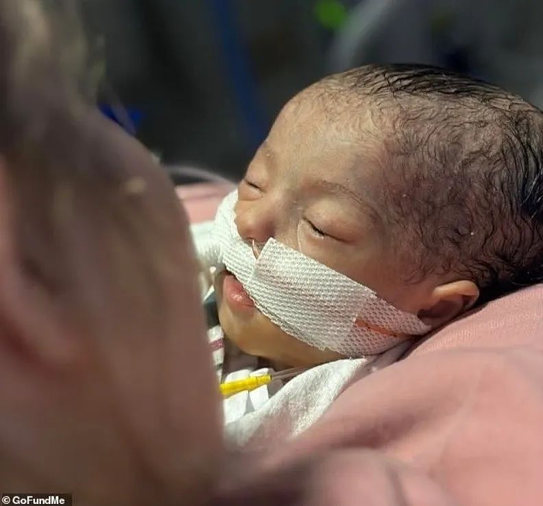 护士把婴儿身上连着的线随手揣兜，结果一转身忘了！婴儿被直接拽落地面，悲剧...（组图） - 2