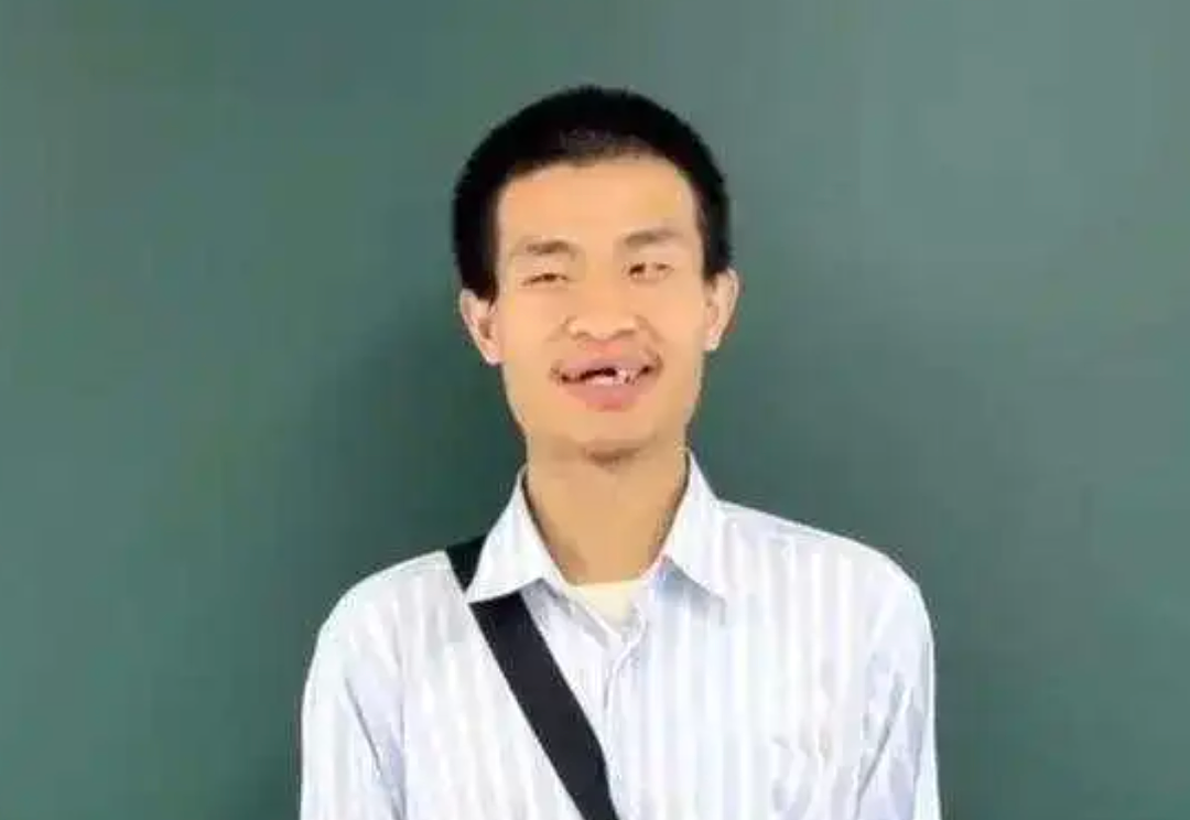 出镜4秒，韦东奕吸粉已超千万！33岁门牙脱落过半引担忧（组图） - 3