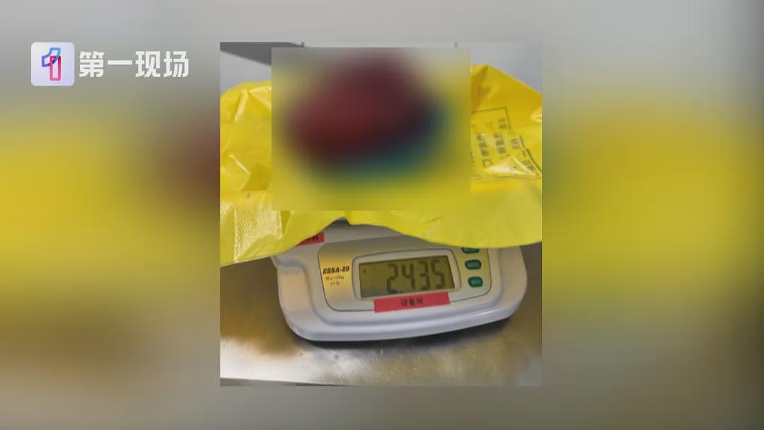 17岁女孩确诊癌症！买衣服时店员看出端倪，这个细节很重要（组图） - 4
