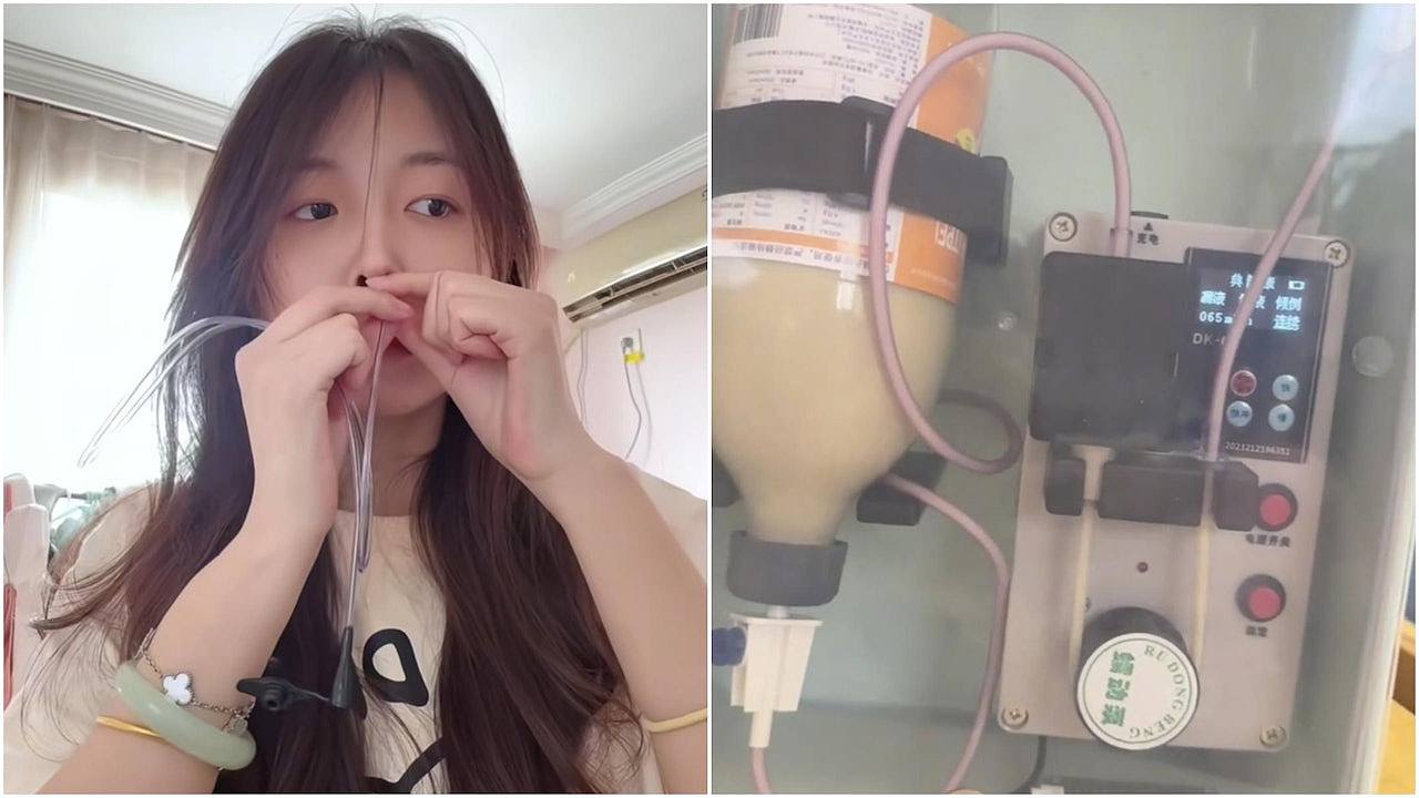 00后女无法正常进食，自学插胃管感动网友，凯特王妃曾被曝患同病（组图） - 1