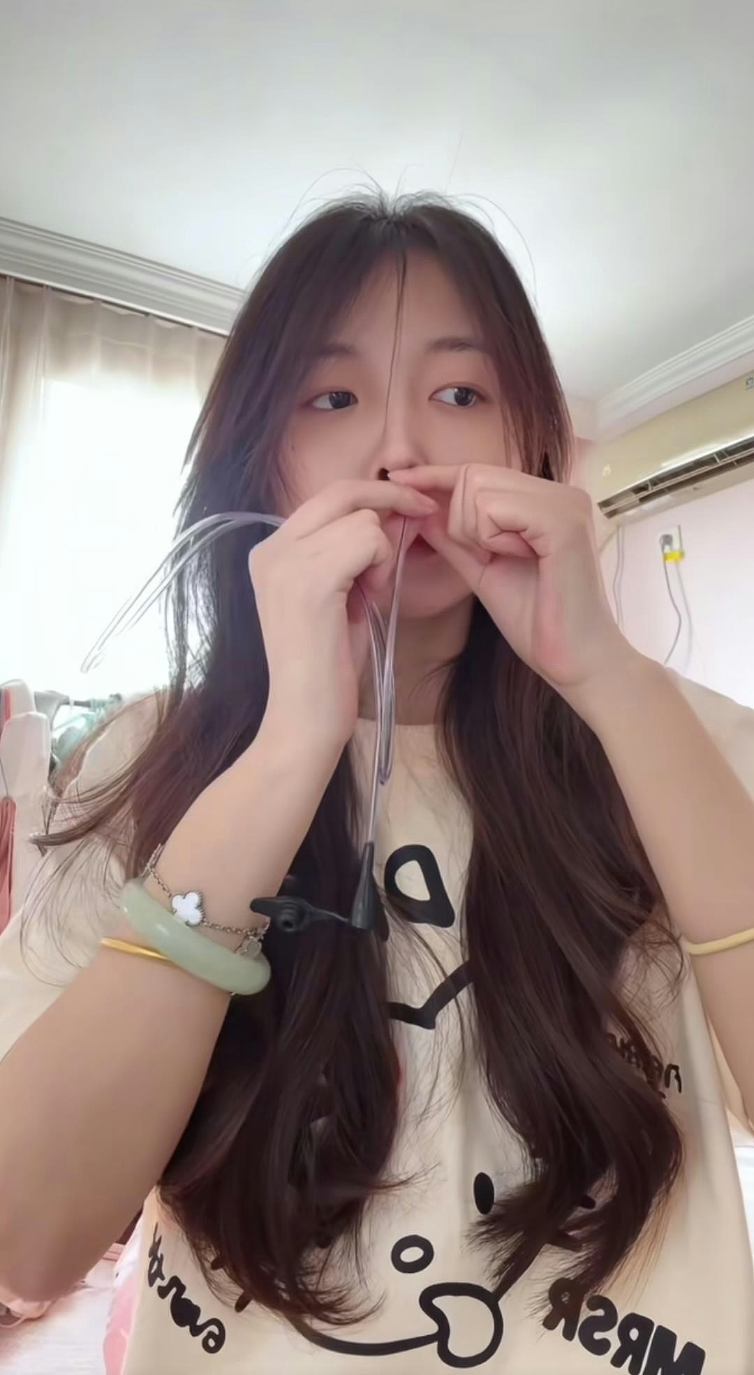 00后女无法正常进食，自学插胃管感动网友，凯特王妃曾被曝患同病（组图） - 4