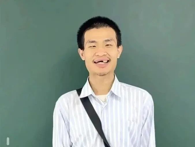 北大“韦神”牙齿问题引关注！这种会让牙齿掉光的病，很多人年轻时不重视（组图） - 1