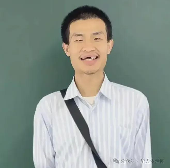 北京大学回应“韦神”健康问题：有比较严重的牙周问题（组图） - 1