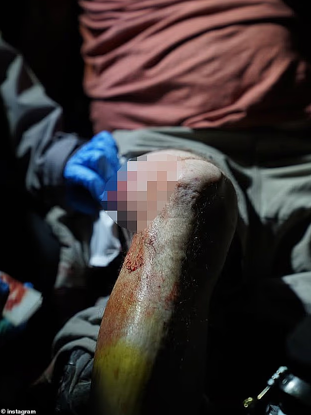 澳洲记者受伤！洛杉矶街头抗议骇人场景持续升级，中领馆紧急提醒（组图） - 17