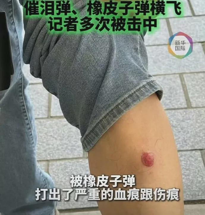 特朗普出事了!太疯狂!美军开进洛杉矶,多方博弈下的社会撕裂...(组图) - 9