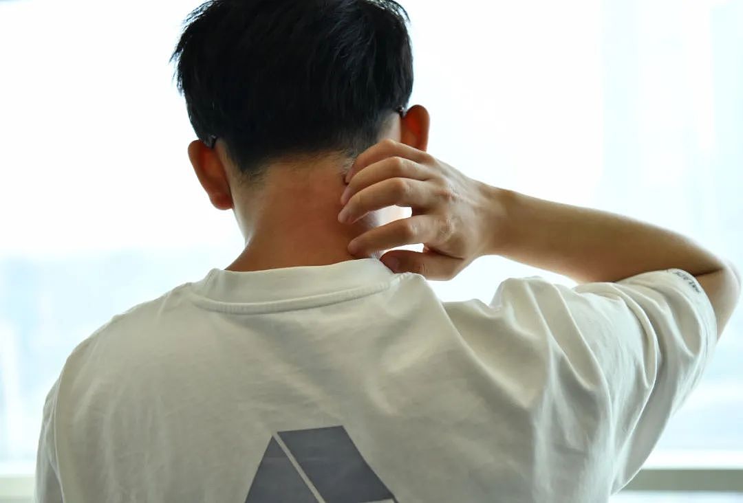 7个被嫌“丑”的身体特征,竟然是身体在偷偷保护你(组图) - 4