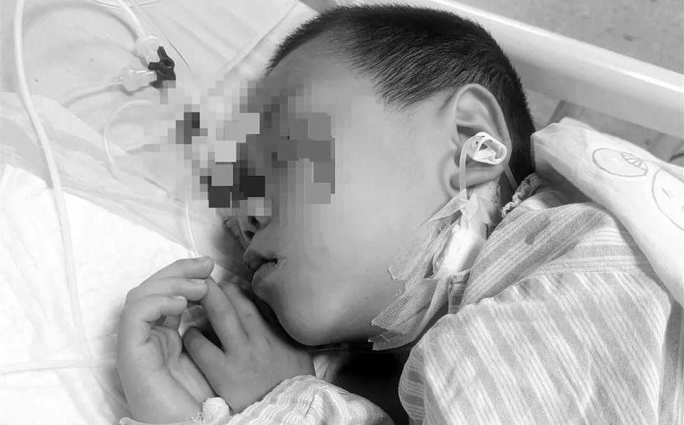 全家6口进ICU，5岁男童不幸去世！福建多地疾控紧急提醒：别吃（组图） - 2