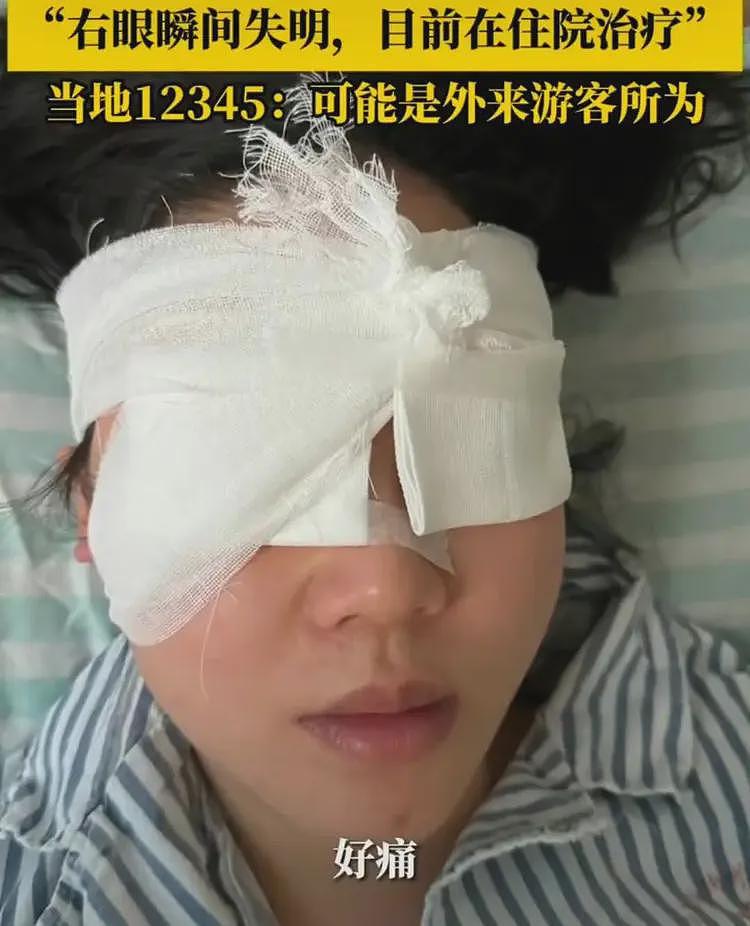女孩漂流遭攻击失明后续!凶手逃逸后被抓,景区甩锅,本人刚订婚(组图) - 19