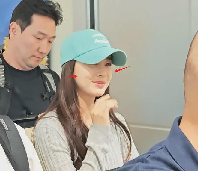 45岁金泰希为医美代言，脸油到反光，曾经的“自然美女”不复存在（组图） - 10