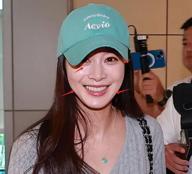 45岁金泰希为医美代言，脸油到反光，曾经的“自然美女”不复存在（组图） - 5