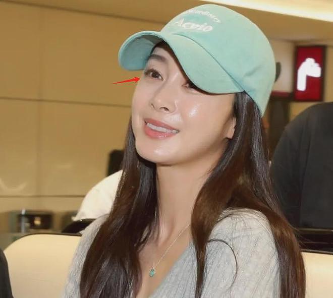 45岁金泰希为医美代言，脸油到反光，曾经的“自然美女”不复存在（组图） - 11