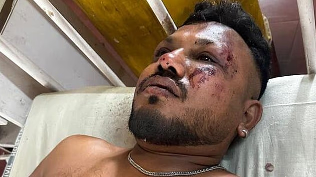 印度空难仅1人奇迹生还！坠机后自行走出残骸求救，亲述地狱逃生经历（视频/组图） - 4