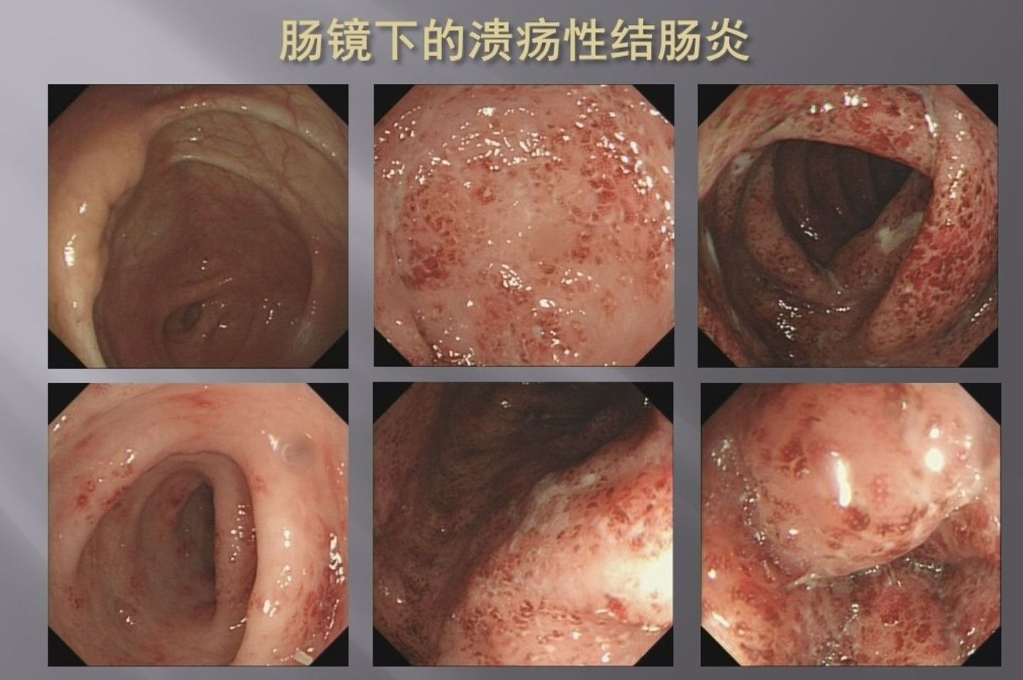 中国22岁男子“泡面配薯片”,连三个月每天拉5次!医叹“需终身服药”(组图) - 2