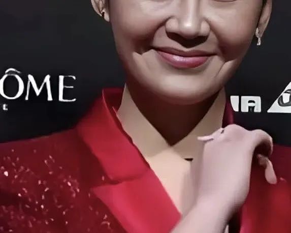 从不老女神到塑胶脸？许晴颜值崩塌背后，竟牵扯惊人内幕（组图） - 1