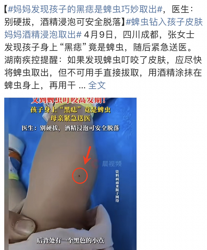 危险！身上忽然冒出这种小黑点，要尽快处理，千万别大意（组图） - 1