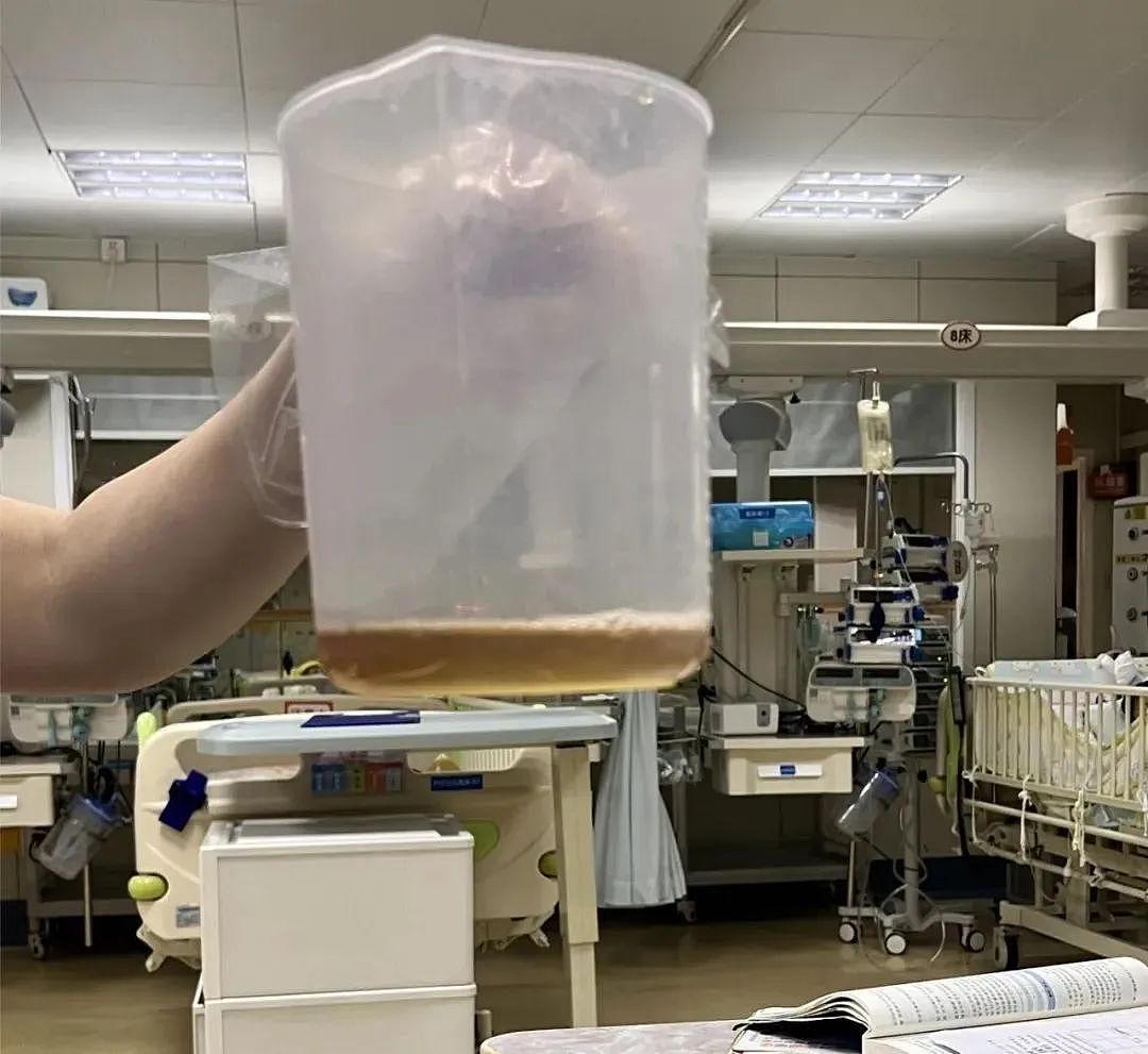 吃了一包零食，5岁娃进了ICU！这病南方高发，很多家长不知道（组图） - 2