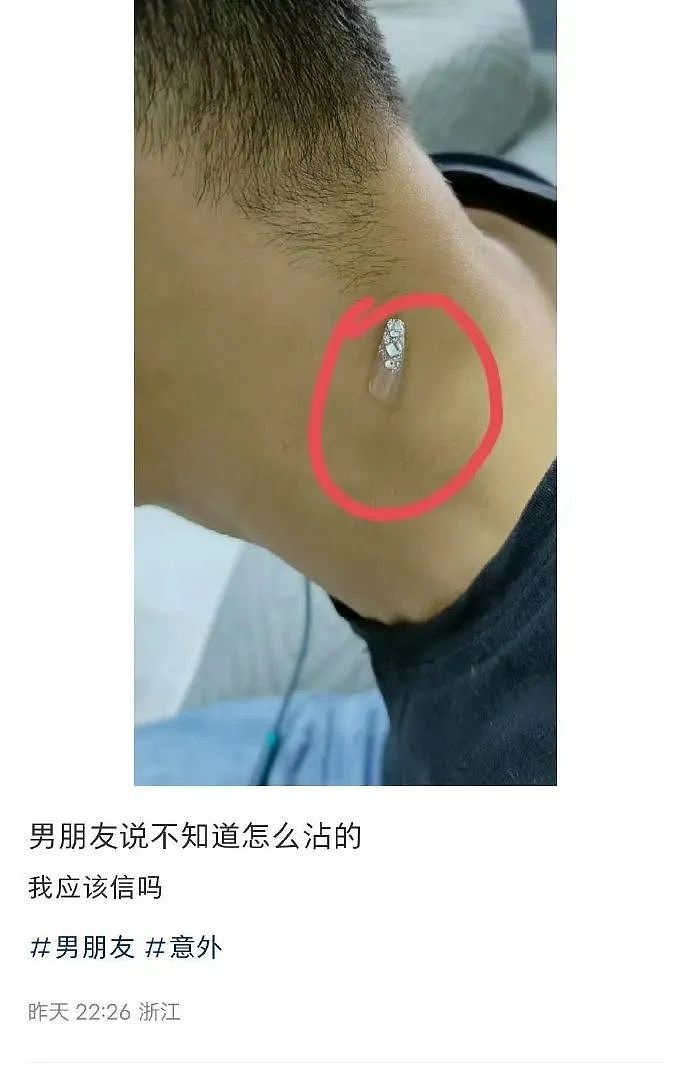 【爆笑】在男朋友脖子上发现粉色的美甲片？说是不小心弄到的，我该信么（组图） - 1