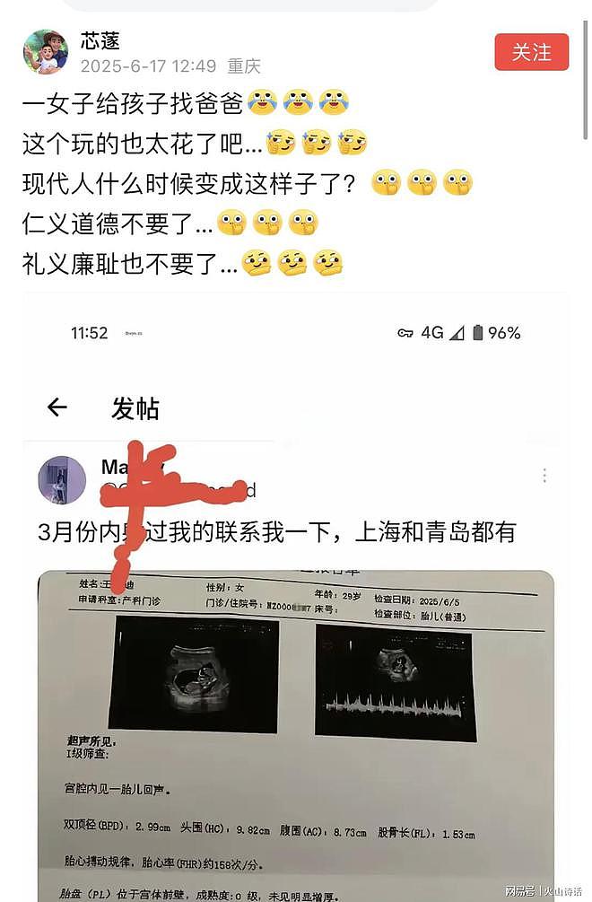 “3月份睡过我的联系一下”一女子发帖给3个月胎儿找亲爹,称上海和青岛的都有可能(组图) - 1